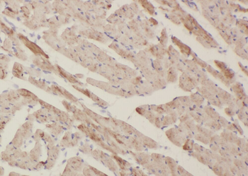 ZFYVE19 Antibody