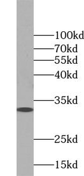 ZMAT3 Rabbit Polyclonal Antibody