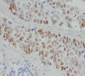 ZMYND8 Antibody