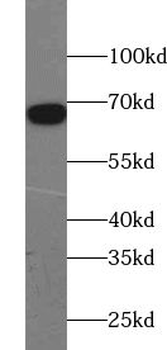 ZNF143 Rabbit Polyclonal Antibody