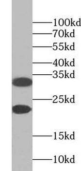 ZNF146 Rabbit Polyclonal Antibody