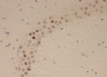 ZBTB18 Antibody