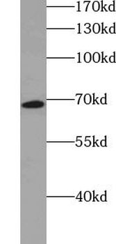 ZNF284 Rabbit Polyclonal Antibody