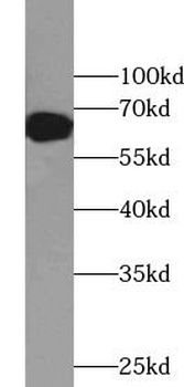ZNF326 Rabbit Polyclonal Antibody