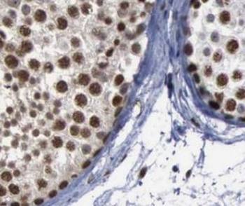 ZNF346 Antibody