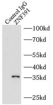 ZNF391 Antibody