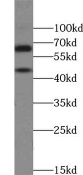 ZNF497 Rabbit Polyclonal Antibody
