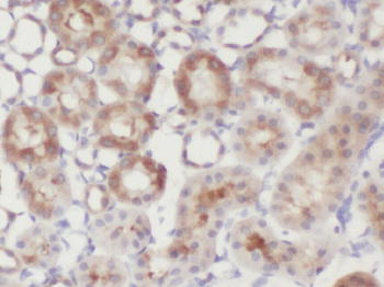 ZNF497 Rabbit Polyclonal Antibody