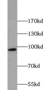 ZNF606 Rabbit Polyclonal Antibody
