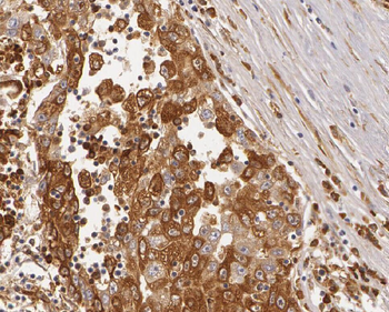 ZNF622 Antibody