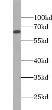 ZNF654 Rabbit Polyclonal Antibody
