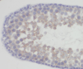 ZNF654 Rabbit Polyclonal Antibody