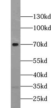 ZNF658 Rabbit Polyclonal Antibody