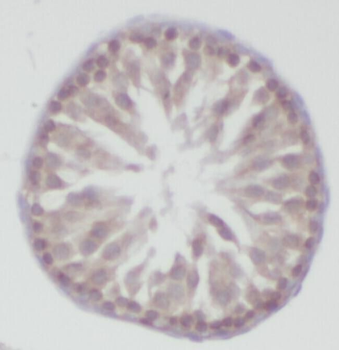 ZNF746 Antibody