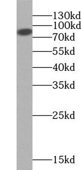 ZNF839 Antibody