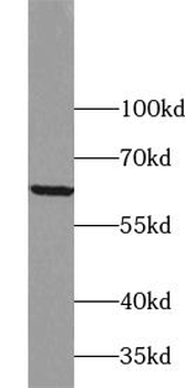 ZNF846 Rabbit Polyclonal Antibody