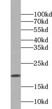 ZNHIT1 Antibody