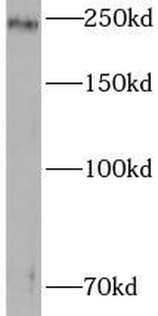 TJP1 Rabbit Polyclonal Antibody