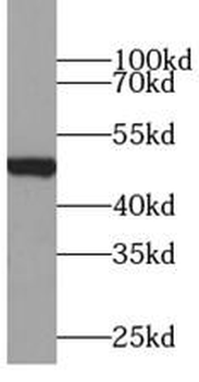 ZRANB2 Antibody