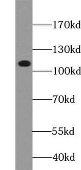 ZSCAN20 Rabbit Polyclonal Antibody