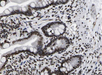 ZSCAN20 Rabbit Polyclonal Antibody