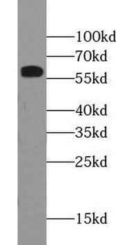 ZSCAN5A Antibody