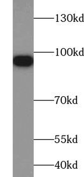 ZW10 Rabbit Polyclonal Antibody
