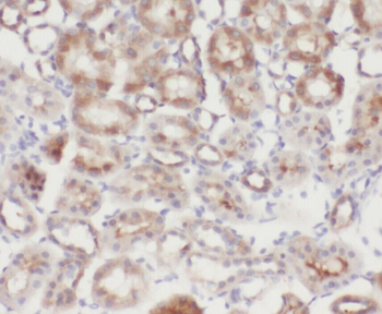 ZYX Antibody
