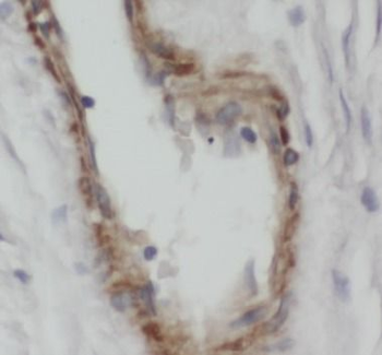 CALCB Antibody