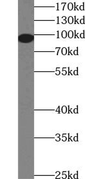 PGR Rabbit Polyclonal Antibody