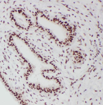 PGR Rabbit Polyclonal Antibody