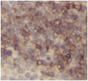 CD45 Mouse Monoclonal Antibody
