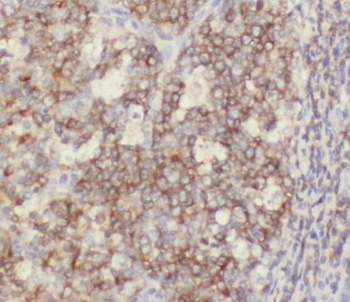 CD6 Rabbit Polyclonal Antibody