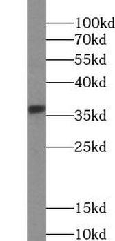 EPCAM Mouse Monoclonal Antibody