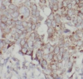 EPCAM Mouse Monoclonal Antibody