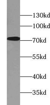 MAP3K3 Antibody