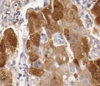 MAP3K3 Antibody
