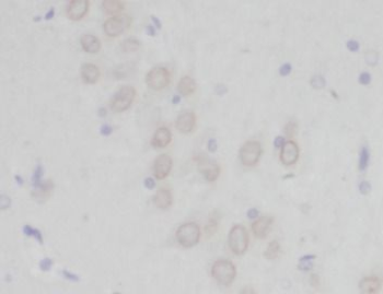 PCDH10 Antibody