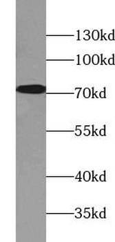 BTN1A1 Rabbit Polyclonal Antibody