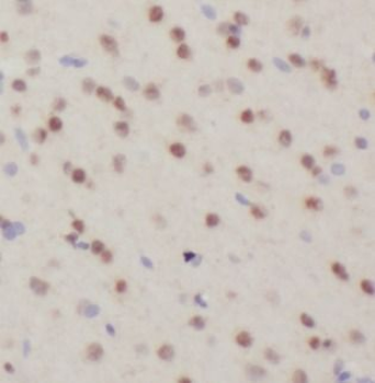 FTO Antibody