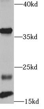 FGF2 Antibody