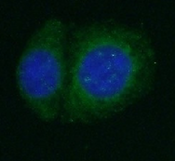 AMH Rabbit Polyclonal Antibody
