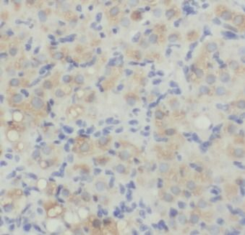 AMH Rabbit Polyclonal Antibody