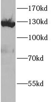 VCL Rabbit Polyclonal Antibody