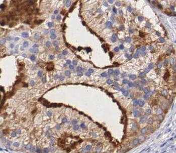 VCL Rabbit Polyclonal Antibody