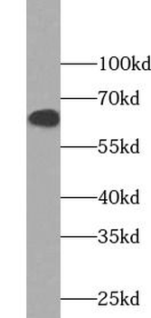FOS Rabbit Polyclonal Antibody