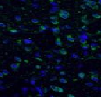 FOS Rabbit Polyclonal Antibody