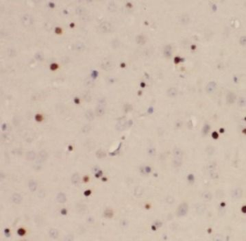 FOS Rabbit Polyclonal Antibody