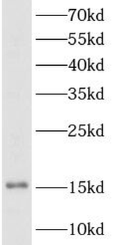 TSHB Antibody