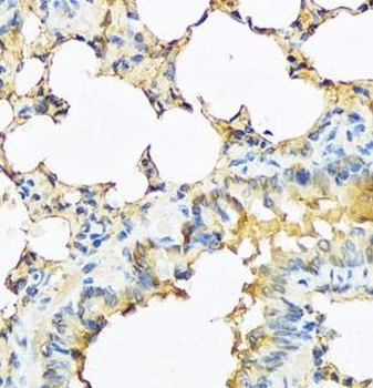 TSHB Antibody